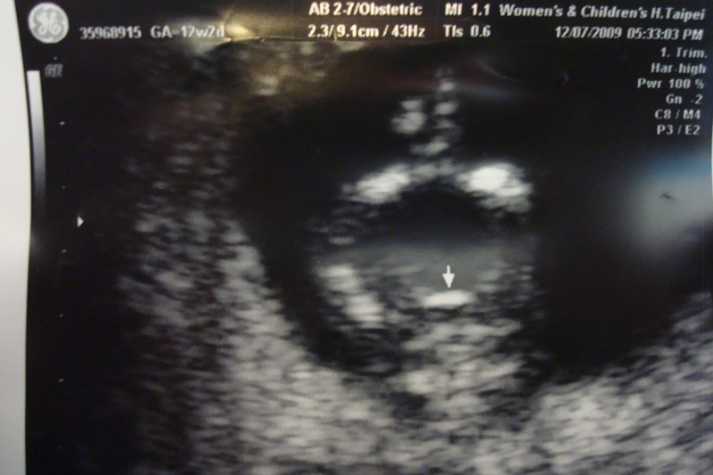 準爸爸日記 9 懷孕15週 啊 我想寫個 囧 字啊 Cloudgary的創作 巴哈姆特